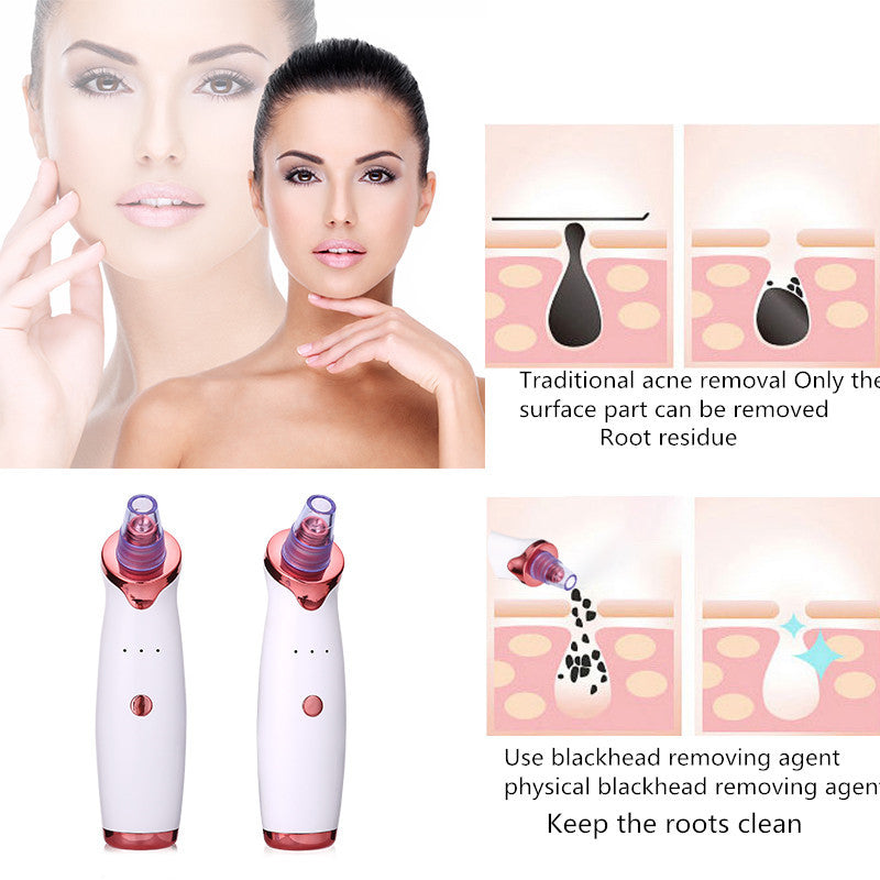 Black Dot Remover Acne Vacuum Suction Face Clean Black Head Pore Cleaning Beauty Skin Care Tool